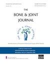 BONE JOINT J