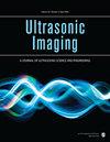 Ultrason. Imaging