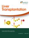 LIVER TRANSPLANT