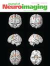 J. Neuroimaging