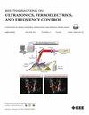 IEEE transactions on ultrasonics, ferroelectrics, and frequency control