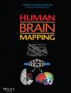 Hum. Brain Mapp.