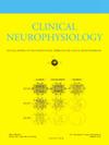 Clin. Neurophysiol.