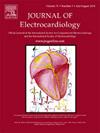 J ELECTROCARDIOL