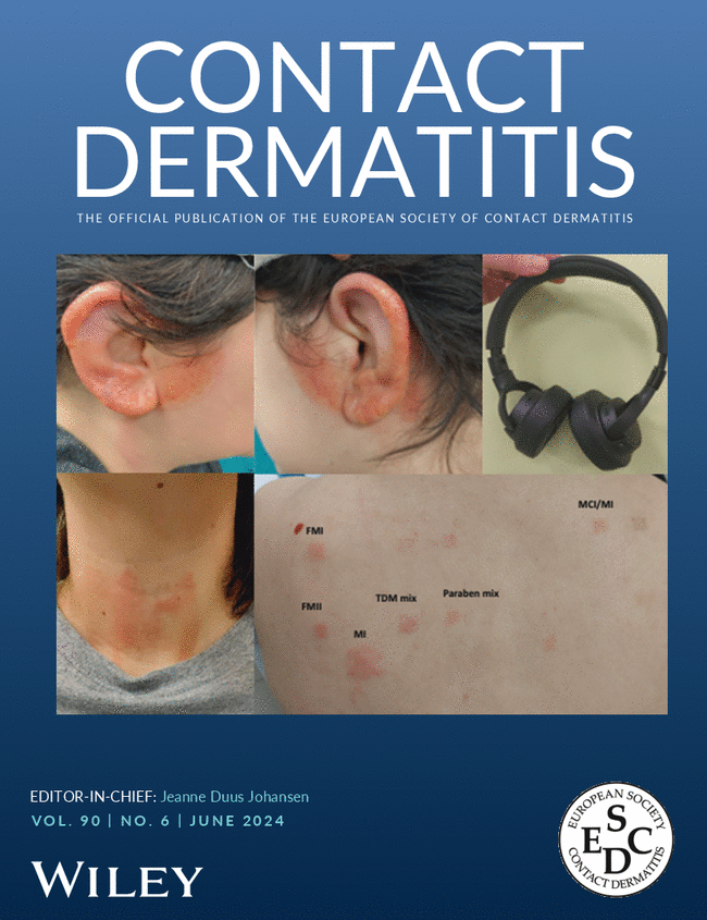 CONTACT DERMATITIS