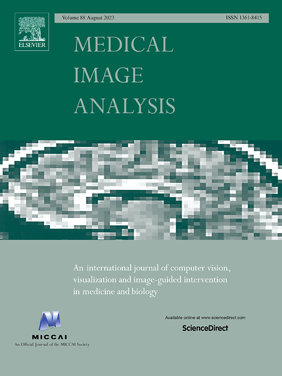 Medical image analysis